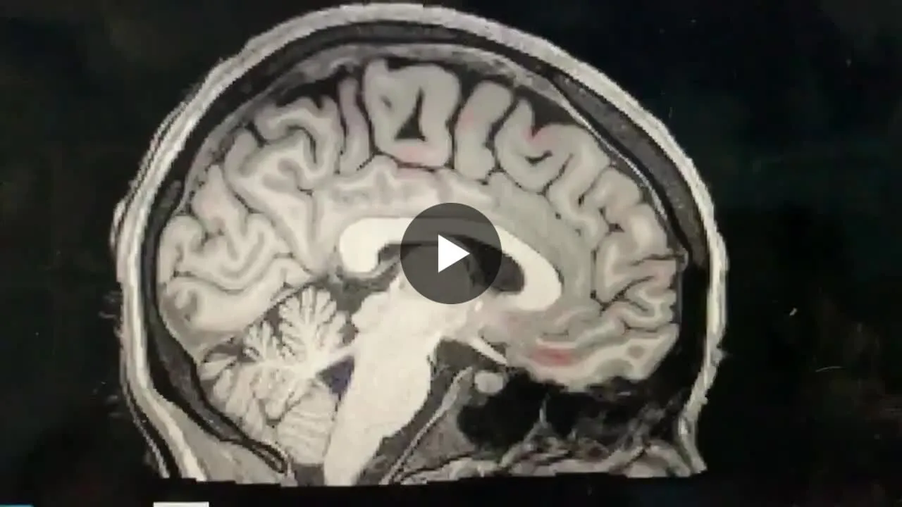 Illustration du post LinkedIn : ✅ Des scientifiques ont observé le lavage du cerveau pendant le sommeil